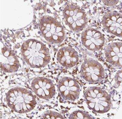 Immunohistochemistry-Paraffin RPS23 Antibody