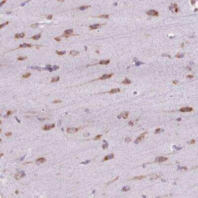 Immunohistochemistry-Paraffin: RPS23 Antibody [NBP2-30412] - Staining of human cerebral cortex shows moderate cytoplasmic positivity in neurons.