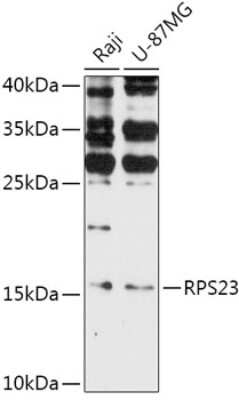 Western Blot: RPS23 Antibody [NBP2-94136] - Analysis of extracts of various cell lines, using RPS23 at 1:1000 dilution. Secondary antibody: HRP Goat Anti-Rabbit IgG (H+L) at 1:10000 dilution. Lysates/proteins: 25ug per lane. Blocking buffer: 3% nonfat dry milk in TBST. Detection: ECL Basic Kit . Exposure time: 90s.