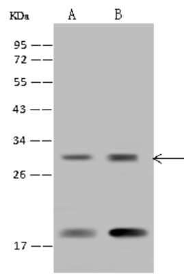 Western Blot: RPS23 Antibody [NBP2-97621] - Anti-RPS23 rabbit polyclonal antibody at 1:500 dilution. Lane A: HEK-293 Whole Cell Lysate Lane B: U-251 MG Whole Cell Lysate Lysates/proteins at 30 ug per lane. Secondary Goat Anti-Rabbit IgG (H+L)/HRP at 1/10000 dilution. Developed using the ECL technique. Performed under reducing conditions. Predicted band size: 16 kDa. Observed band size: 18 kDa