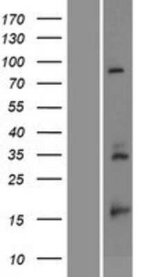 Western Blot: RPS23 Overexpression Lysate (Adult Normal) [NBP2-08647] Left-Empty vector transfected control cell lysate (HEK293 cell lysate); Right -Over-expression Lysate for RPS23.