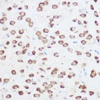 Immunohistochemistry-Paraffin: RPS24 Antibody [NBP2-93809] - Immunohistochemistry of paraffin-embedded rat brain using RPS24 Rabbit pAb (NBP2-93809) at dilution of 1:200 (40x lens). Perform high pressure antigen retrieval with 10 mM citrate buffer pH 6.0 before commencing with IHC staining protocol.