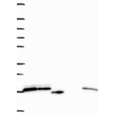 Western Blot: RPS24 Antibody [NBP3-17432] - Lane 1: Marker [kDa] 250, 130, 95, 72, 55, 36, 28, 17, 10 | Lane 2: RT4 | Lane 3: U-251 MG | Lane 4: Human Plasma | Lane 5: Liver | Lane 6: Tonsil