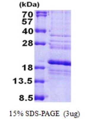 SDS-PAGE Recombinant Human RPS24 His Protein