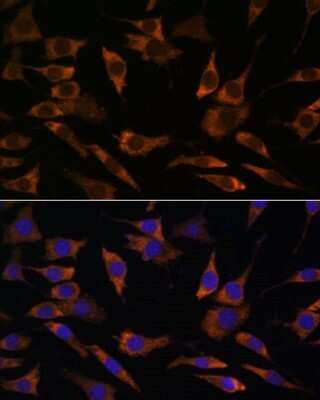 Immunocytochemistry/ Immunofluorescence RPS25 Antibody - Azide and BSA Free