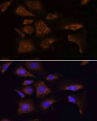 Immunocytochemistry/ Immunofluorescence RPS25 Antibody - Azide and BSA Free