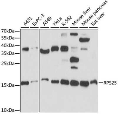 Western Blot RPS25 Antibody - Azide and BSA Free