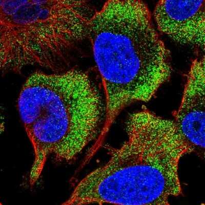 Immunocytochemistry/Immunofluorescence: RPS26 Antibody [NBP2-55581] - Staining of human cell line U-251 MG shows localization to cytosol & endoplasmic reticulum.