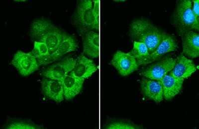 Immunocytochemistry/Immunofluorescence: RPS26 Antibody [NBP3-13001] - RPS26 antibody detects RPS26 protein at cytoplasm by immunofluorescent analysis. Sample: MCF-7 cells were fixed in 4% paraformaldehyde at RT for 15 min. Green: RPS26 stained by RPS26 antibody (NBP3-13001) diluted at 1:500. Blue: Fluoroshield with DAPI.