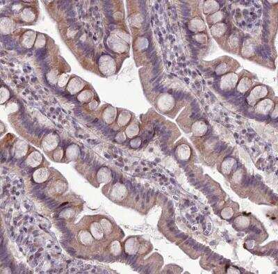 Immunohistochemistry-Paraffin RPS26 Antibody