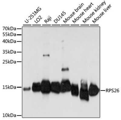 Western Blot: RPS26 Antibody [NBP2-95172] - Analysis of extracts of various cell lines, using RPS26 at 1:1000 dilution. Secondary antibody: HRP Goat Anti-Rabbit IgG (H+L) at 1:10000 dilution. Lysates/proteins: 25ug per lane. Blocking buffer: 3% nonfat dry milk in TBST. Detection: ECL Basic Kit . Exposure time: 30s.