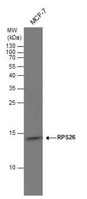 Western Blot: RPS26 Antibody [NBP3-13001] - RPS26 antibody detects RPS26 protein by western blot analysis. Various whole cell extracts (30 ug) were separated by 15% SDS-PAGE, and the membrane was blotted with RPS26 antibody (NBP3-13001) diluted at 1:500.