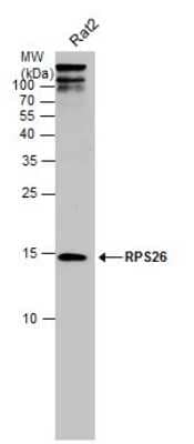 Western Blot: RPS26 Antibody [NBP3-13001] - Whole cell extract (30 ug) was separated by 15% SDS-PAGE, and the membrane was blotted with RPS26 antibody (NBP3-13001) diluted at 1:500.