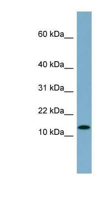 Western Blot: RPS27L Antibody [NBP1-56857] - MCF-7 whole cell lysates, concentration 0.2-1 ug/ml.
