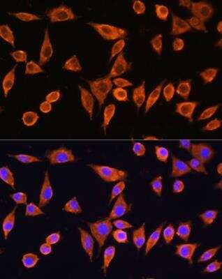 Immunocytochemistry/ Immunofluorescence RPS28 Antibody - Azide and BSA Free