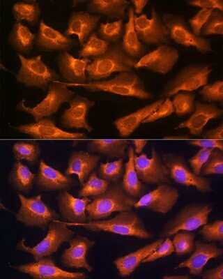 Immunocytochemistry/ Immunofluorescence RPS28 Antibody - Azide and BSA Free