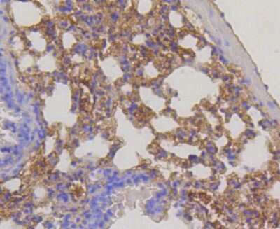Immunohistochemistry-Paraffin: RPS3 Antibody (SA46-08) [NBP2-67301] - Analysis of paraffin-embedded mouse lung tissue using anti-RPS3 antibody. Counter stained with hematoxylin.