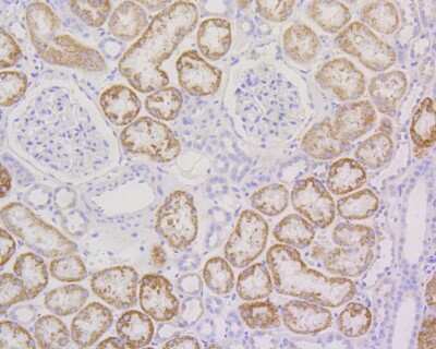 Immunohistochemistry-Paraffin: RPS3 Antibody (SA46-08) [NBP2-67301] - Immunohistochemical analysis of paraffin-embedded human kidney tissue using anti-RPS3 antibody. The section was pre-treated using heat mediated antigen retrieval with Tris-EDTA buffer (pH 8.0-8.4) for 20 minutes. The tissues were blocked in 5% BSA for 30