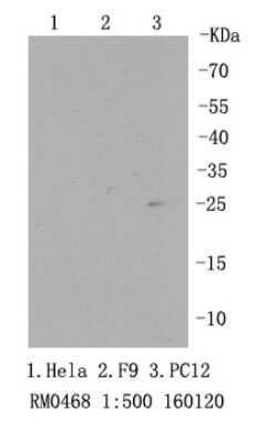 Western Blot: RPS3 Antibody (SA46-08) [NBP2-67301] - Analysis of RPS3 on PC12 cell lysates using anti-RPS3 antibody at 1/500 dilution.