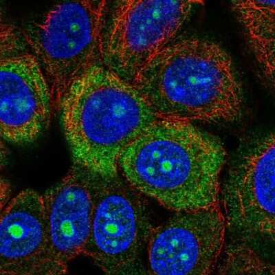 Immunocytochemistry/Immunofluorescence: RPS3A Antibody [NBP2-55339] - Staining of human cell line MCF7 shows localization to nucleoli, cytosol & endoplasmic reticulum.