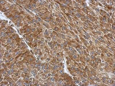 Immunohistochemistry-Paraffin: RPS3A Antibody [NBP2-20225] - Immunohistochemical analysis of paraffin-embedded U87 xenograft, using antibody at 1:500 dilution.