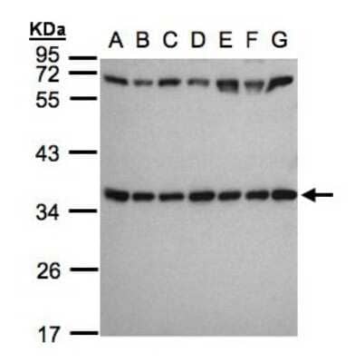 Western Blot: RPS3A Antibody [NBP1-31598] - Sample(30 ug whole cell lysate)A: 293T B: A431 C:H1299 D:HeLa S3 E: Hep G2 F: MOLT4 G: Raji 12% SDS PAGE, antibody diluted at 1:1000.