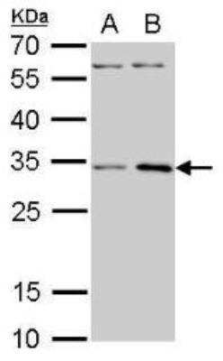 Western Blot: RPS3A Antibody [NBP1-31598] - RPS3A antibody detects RPS3A protein by Western blot analysis. A. 30 ug PC-12 whole cell lysate/extract. B. 30 ug Rat2 whole cell lysate/extract. 12 % SDS-PAGERPS3A antibody dilution: 1:1000.
