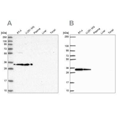 Western Blot: RPS3A Antibody [NBP2-13264] - Analysis using Anti-RPS3A antibody NBP2-13264 (A) shows similar pattern to independent antibody NBP2-55339 (B).