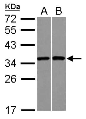 Western Blot RPS3A Antibody