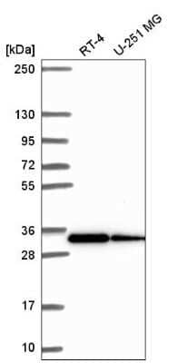 Western Blot: RPS3A Antibody [NBP2-55339] - Western blot analysis in human cell line RT-4 and human cell line U-251 MG.