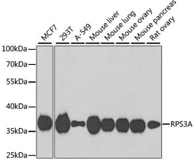 Western Blot: RPS3A Antibody [NBP2-94503] - Analysis of extracts of various cell lines, using RPS3A at 1:1000 dilution. Secondary antibody: HRP Goat Anti-Rabbit IgG (H+L) at 1:10000 dilution. Lysates/proteins: 25ug per lane. Blocking buffer: 3% nonfat dry milk in TBST. Detection: ECL Basic Kit . Exposure time: 90s.
