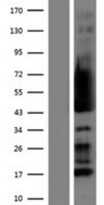 Western Blot: RPS5 Overexpression Lysate (Adult Normal) [NBP2-08703] Left-Empty vector transfected control cell lysate (HEK293 cell lysate); Right -Over-expression Lysate for RPS5.