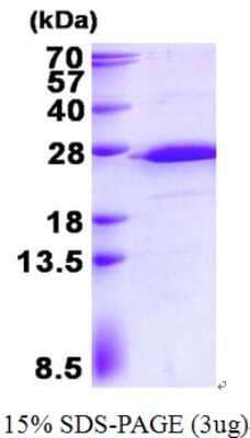 SDS-Page: RPS5 Protein [NBP2-23437]