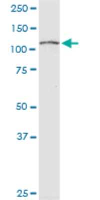 Western Blot: RPS6KC1 Antibody (4C6) [H00026750-M01] - RPS6KC1 monoclonal antibody (M01), clone 4C6. Analysis of RPS6KC1 expression in HepG2.