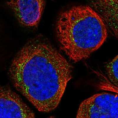 Immunocytochemistry/Immunofluorescence: RPS6KC1 Antibody [NBP1-83141] - Immunofluorescent staining of human cell line A-431 shows localization to vesicles.