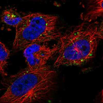 Immunocytochemistry/Immunofluorescence: RPS6KC1 Antibody [NBP2-54999] - Staining of human cell line U-251 MG shows localization to endosomes & lysosomes.