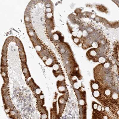 Immunohistochemistry-Paraffin: RPS6KC1 Antibody [NBP1-83141] - Staining of human duodenum shows strong cytoplasmic positivity in glandular cells.
