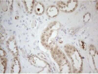 Immunohistochemistry: RPS6KC1 Antibody (OTI10F11) - Azide and BSA Free [NBP2-73946] - Staining of paraffin-embedded Human Kidney tissue using anti-RPS6KC1 mouse monoclonal antibody.