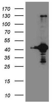 Western Blot: RPS6KC1 Antibody (OTI10F11) - Azide and BSA Free [NBP2-73946] - HEK293T cells were transfected with the pCMV6-ENTRY control (Left lane) or pCMV6-ENTRY RPS6KC1 (Right lane) cDNA for 48 hrs and lysed. Equivalent amounts of cell lysates (5 ug per lane) were separated by SDS-PAGE and immunoblotted with anti-RPS6.