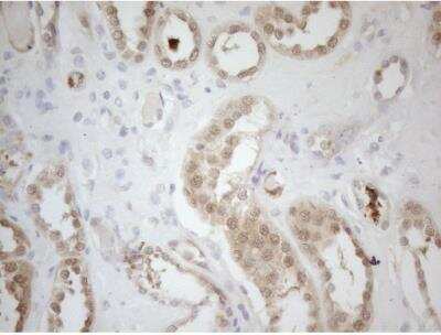 Immunohistochemistry-Paraffin: RPS6KC1 Antibody (OTI10F11) [NBP2-45635] - Staining of paraffin-embedded Human Kidney tissue using anti-RPS6KC1 mouse monoclonal antibody. 