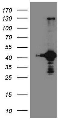 Western Blot: RPS6KC1 Antibody (OTI10F11) [NBP2-45635] - HEK293T cells were transfected with the pCMV6-ENTRY control (Left lane) or pCMV6-ENTRY RPS6KC1 (Right lane) cDNA for 48 hrs and lysed. Equivalent amounts of cell lysates (5 ug per lane) were separated by SDS-PAGE and immunoblotted with anti-RPS6. 