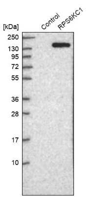 Western Blot: RPS6KC1 Antibody [NBP1-83141] - Analysis in control (vector only transfected HEK293T lysate) and RPS6KC1 over-expression lysate (Co-expressed with a C-terminal myc-DDK tag (3.1 kDa) in mammalian HEK293T cells).