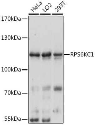 Western Blot: RPS6KC1 Antibody [NBP2-94674] - Analysis of extracts of various cell lines, using RPS6KC1 at 1:3000 dilution. Secondary antibody: HRP Goat Anti-Rabbit IgG (H+L) at 1:10000 dilution. Lysates/proteins: 25ug per lane. Blocking buffer: 3% nonfat dry milk in TBST. Detection: ECL Basic Kit . Exposure time: 10s.