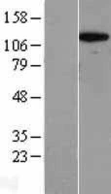 Western Blot: RPS6KC1 Overexpression Lysate (Adult Normal) [NBL1-15576] Left-Empty vector transfected control cell lysate (HEK293 cell lysate); Right -Over-expression Lysate for RPS6KC1.