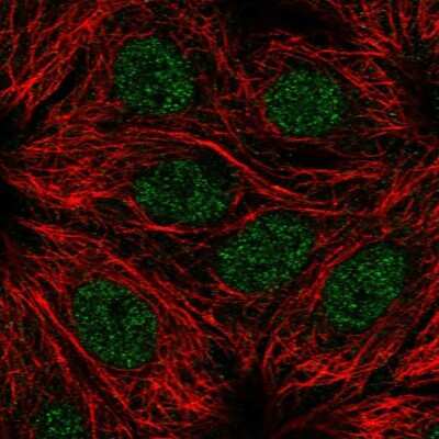 Immunocytochemistry/Immunofluorescence: RPS6KL1 Antibody [NBP1-81226] - Immunofluorescent staining of human cell line MCF7 shows localization to nucleoplasm.