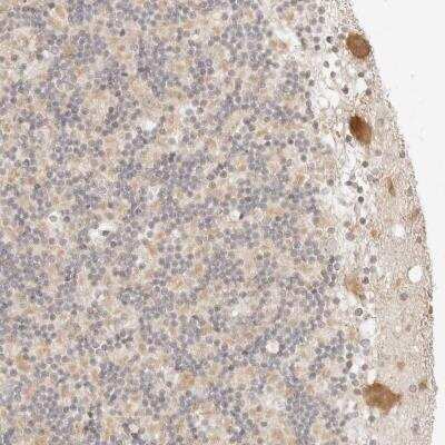 Immunohistochemistry: RPS6KL1 Antibody [NBP1-81225] - Staining of human cerebellum shows moderate cytoplasmic positivity in Purkinje cells.