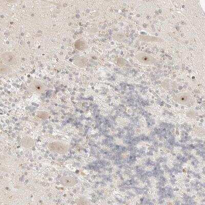 Immunohistochemistry: RPS6KL1 Antibody [NBP1-81226] - Staining of human cerebellum shows nucleolar positivity in Purkinje cells.