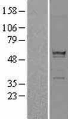 Western Blot: RPS6KL1 Overexpression Lysate (Adult Normal) [NBL1-15577] Left-Empty vector transfected control cell lysate (HEK293 cell lysate); Right -Over-expression Lysate for RPS6KL1.