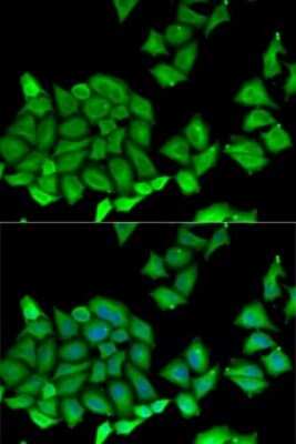 Immunocytochemistry/Immunofluorescence: RPS7 Antibody [NBP2-94119] - Analysis of U2OS cells using RPS7 . Blue: DAPI for nuclear staining.