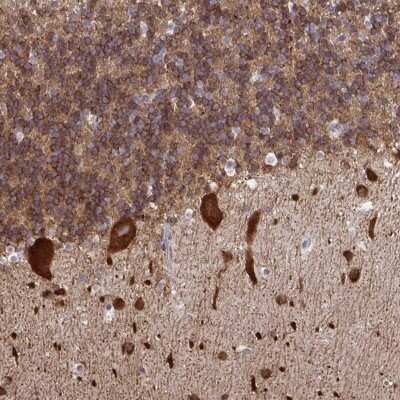 Immunohistochemistry-Paraffin: RPS7 Antibody [NBP2-33793] - Staining of human cerebellum shows strong cytoplasmic positivity in Purkinje cells along with cells in molecular and granular layer.